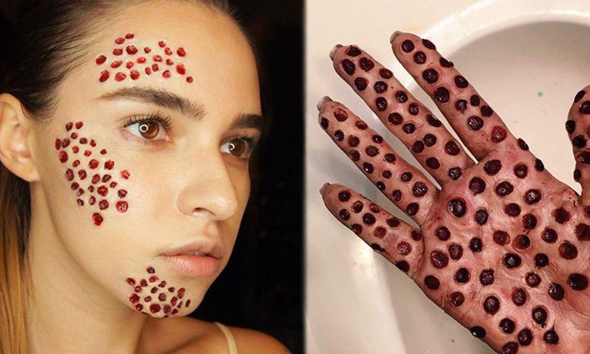 trypophobia