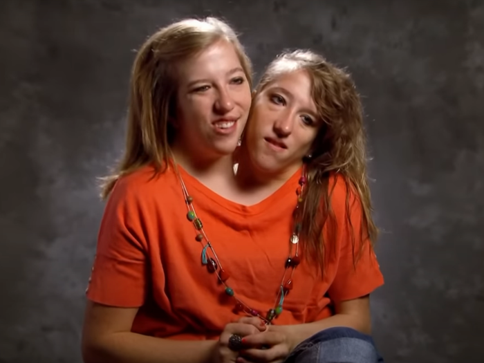 Abby And Brittany Hensel