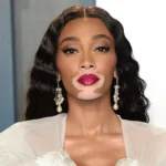 Winnie Harlow