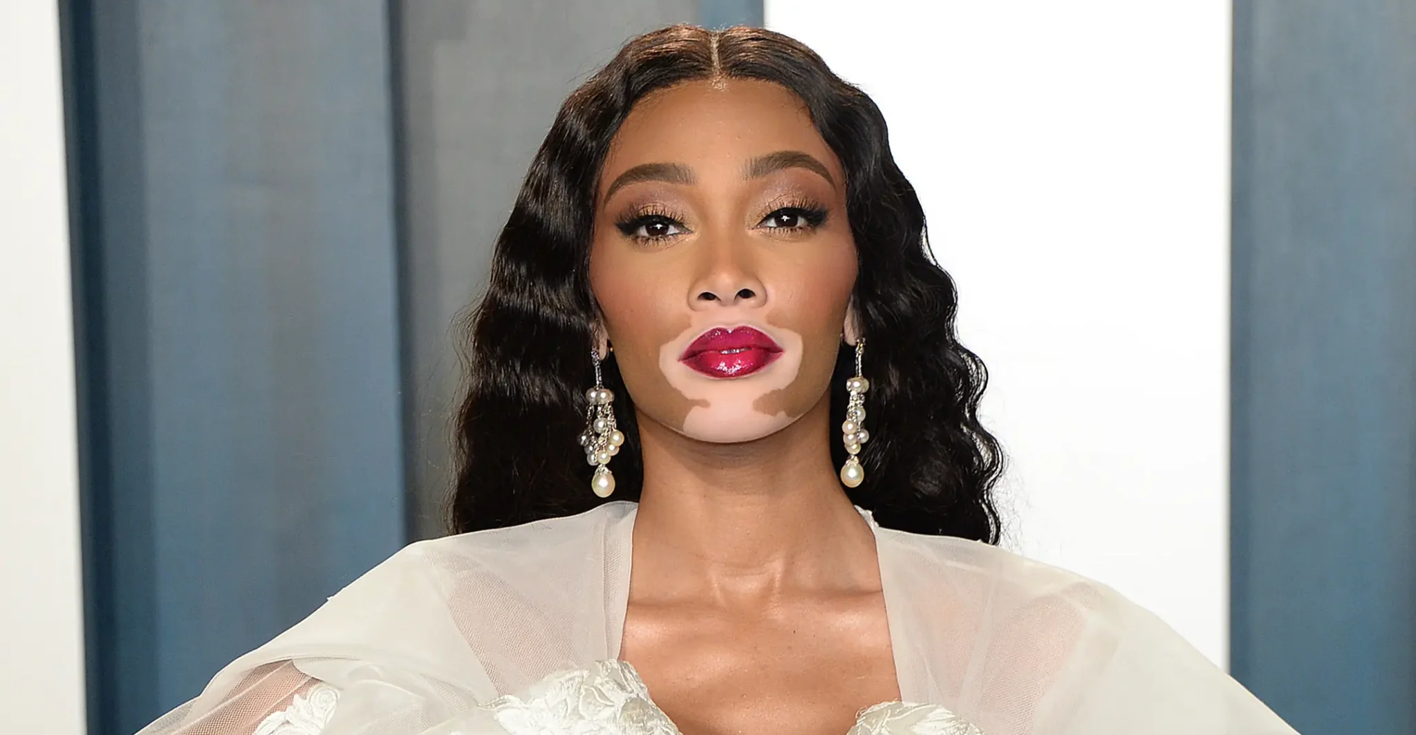 Winnie Harlow