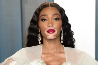 Winnie Harlow