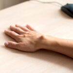 ganglion handgelenk op wie lange krank