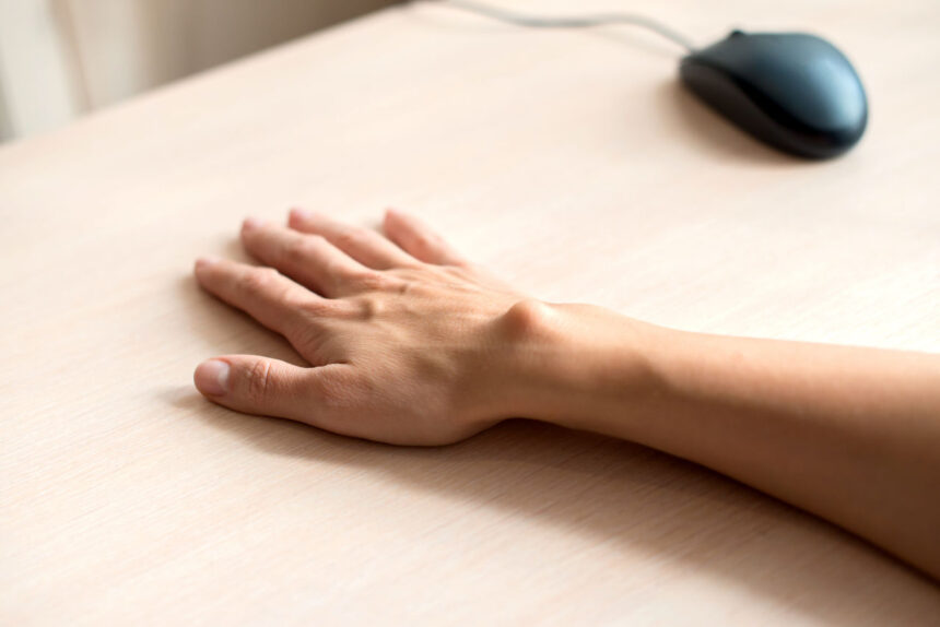 ganglion handgelenk op wie lange krank